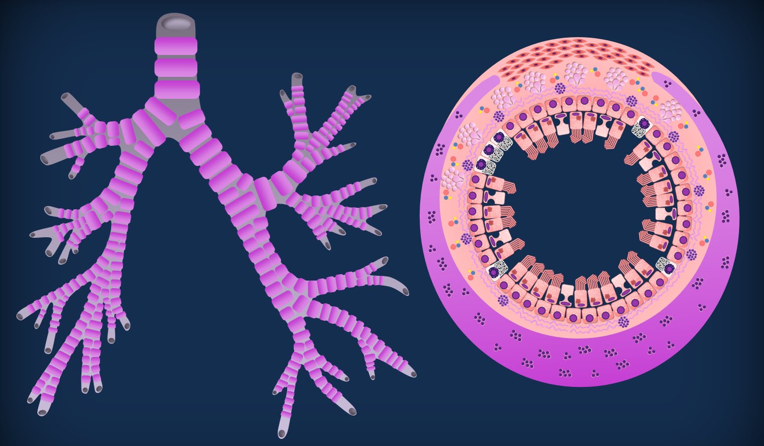 TRACHEA E BRONCHI