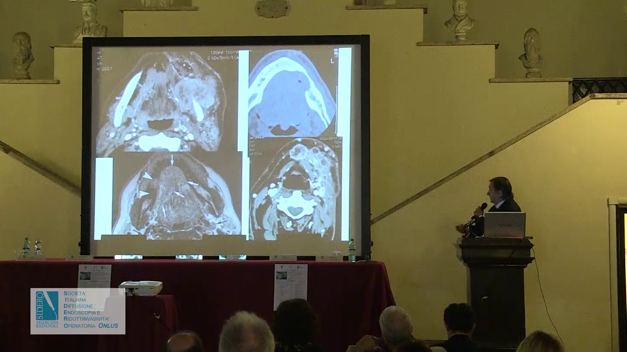 IL RECUPERO DI FUNZIONE ED EFFICIENZA NELLA VIA RESPIRATORIA: E’ ANCORA SOLO PER POCHI? MARCO RADICI