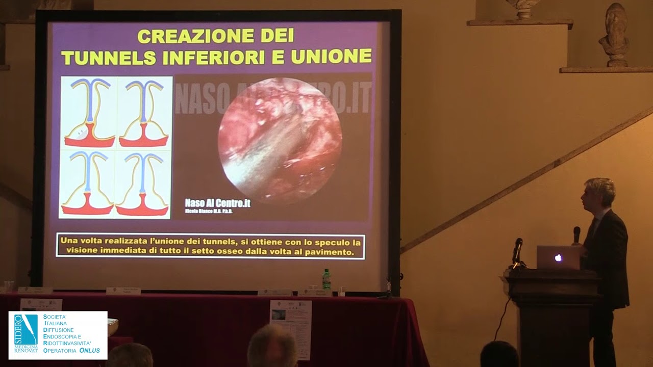 IL RECUPERO DI FUNZIONE ED EFFICIENZA NELLA VIA RESPIRATORIA: E’ ANCORA SOLO PER POCHI? NICOLA BIANCO